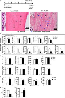 Effect of Osteocyte-Ablation on Inorganic Phosphate Metabolism: Analysis of Bone–Kidney–Gut Axis